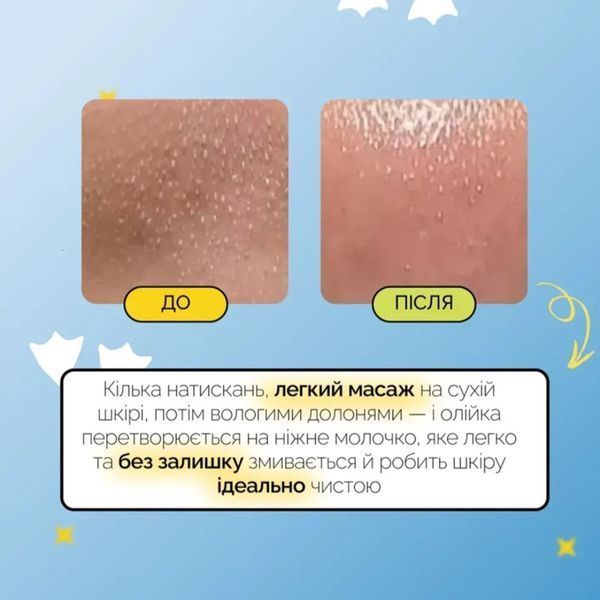 Гідрофільна олійка для глибокого очищення пор Medicube Zero Pore Blackhead Deep Cleansing Oil MC05 фото